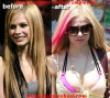 avril lavigne nin gecirdigi degisim / #257389