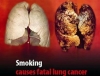 akciğer kanseri